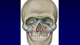 Facial Fractures 1 [upl. by Sikram705]