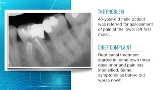 Advances in Endodontic Treatment Part 1Diagnosis and Treatment Planning [upl. by Odlonyer]