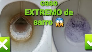 Como limpiar baño lleno de SARRO [upl. by Fagin265]