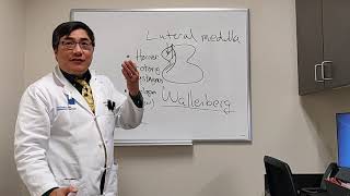 Lateral Medullary syndrome  Wallenberg syndrome [upl. by Anelaf]