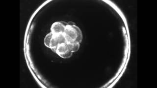 Blastocysts  5 Things IVF Patients Should Know [upl. by Ritter]