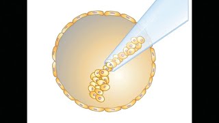 Blastocyst Transfer in IVF Success rate Implantation Procedure Grading Embryo Culture Biopsy [upl. by Azeria]