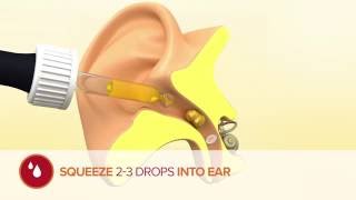 How to use Otex Olive Oil Ear Drops [upl. by Haliled282]