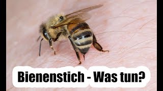 Bienenstich  Was tun Das empfiehlt der Arzt [upl. by Yennor]