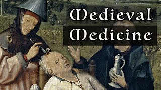 Medieval Medicine Everything You Need To Know [upl. by Woolcott]