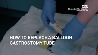 How to replace a balloon Gastrostomy Tube [upl. by Beall376]