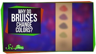 Why Do Bruises Change Colors [upl. by Etnad]