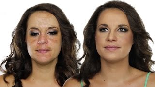 How To Cover Hyperpigmentation  Skin Pigmentation Using MakeUp  Shonagh Scott  ShowMe MakeUp [upl. by Oehsen]