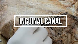 Inguinal Canal [upl. by Feenah905]