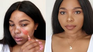 HOW TO COVER HYPERPIGMENTATION AND DARK SPOTS ON BROWN SKIN [upl. by Kcirdderf799]