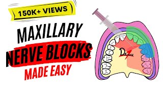 Maxillary Nerve Block Anesthesia For Dental Procedures [upl. by Aileno]