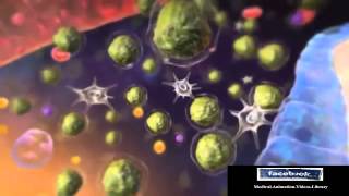 Acute Lymphocytic Leukemia ALL Animation [upl. by Aveer]