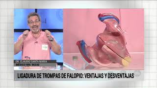 MICRO SALUD 54  Ligadura de trompas de falopio ventajas y desventajas [upl. by Ysteb]