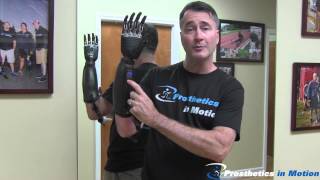 Below The Elbow Amputee Demonstrates BeBionic 3 Myoelectric Prosthesis [upl. by Duky608]