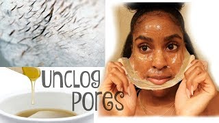 DIY Milk Peel Off Mask UNPLUG Blackheads Whiteheads amp Unwanted Hair [upl. by Acnayb332]