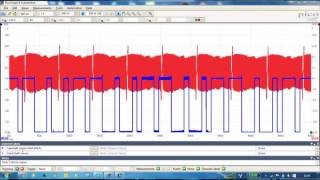 Testing the Cam and crank sensors [upl. by Raman4]