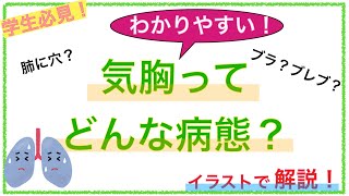 教科書をわかりやすく！「気胸ってどんな病態？」 [upl. by Repinuj633]