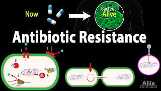 Antibiotic Resistance Animation [upl. by Gregg67]