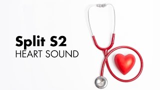 Fixed Split S2  Heart Sounds  MEDZCOOL [upl. by Libnah339]