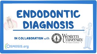 Endodontic Diagnosis in Collaboration w Western University [upl. by Esemaj616]