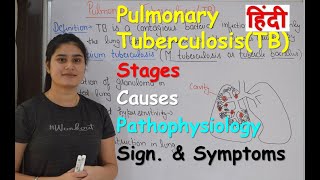 Pulmonary Tuberculosis in Hindi  Stages  Causes  Pathophysiology  Sign amp Symptoms [upl. by Wehtta]