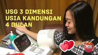 USG 3 DIMENSI USIA KEHAMILAN 4 BULAN 1 MINGGU  MENGETAHUI JENIS KELAMIN BAYI [upl. by Auqinet]