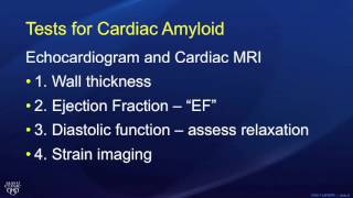 Dilated cardiomyopathy  Symptoms causes treatment [upl. by Ennaillek]