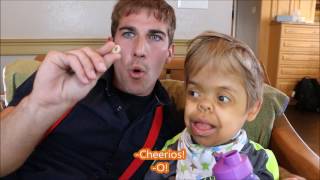 The Miracle Mann Thanatophoric Dysplasia Dwarfism [upl. by Gnahc]