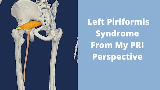 Understanding Left Piriformis Syndrome [upl. by Ruben]