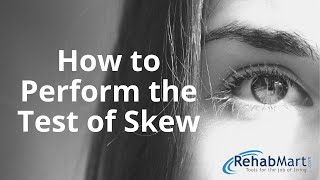 How to Perform the Test of Skew for Vertigo [upl. by Herta]