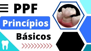 PRINCÍPIOS BÁSICOS para a CONFECÇÃO da PRÓTESE FIXA [upl. by Adnirual52]