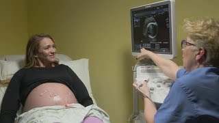 Ultrasounds during pregnancy [upl. by Ydaf]