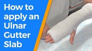 How to apply an Ulnar Gutter Slab [upl. by Ylrebmi338]