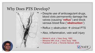 Understanding Postthrombotic Syndrome [upl. by Fong926]