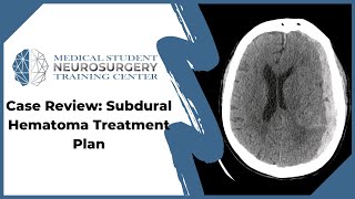 Case Review Subdural Hematoma Treatment Plan [upl. by Ramirol537]