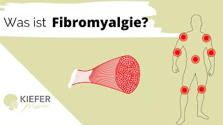 Fibromyalgie  Symptome amp Diagnose [upl. by Hagan928]