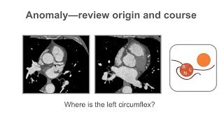 Cardiac Development by L McCabe  OPENPediatrics [upl. by Glover]