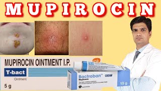 T bact ointment  Bactroban ointment  Mupirocin ointment uses side effects how to apply [upl. by Kier71]