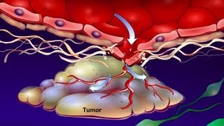 Introduction to Cancer Biology Part 4 Angiogenesis [upl. by Ewold412]