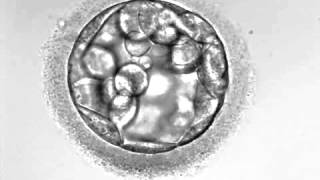 TimeLapse  Embryo development ENG first 100 hours [upl. by Wilhelmina]