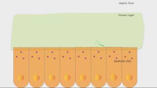 H Pylori and Ulcers [upl. by Starling985]