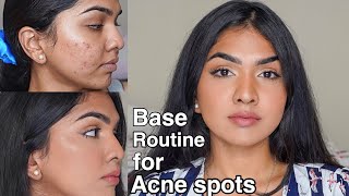 Flawless base routine for acne prone skin  acne pigmentation [upl. by Langley]