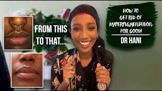 How To Get Rid Of Hyperpigmentation  Dr Hani [upl. by Hsur]