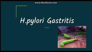 Helicobacter pylori gastritis Pathogenesis and morphology [upl. by Onairam]