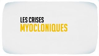 Les crises myocloniques [upl. by Wes606]