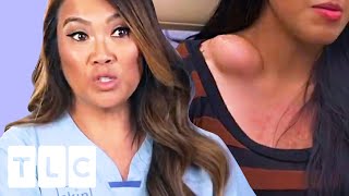 The Contents Of This Huge Bump Surprises Dr Lee  Dr Pimple Popper [upl. by Walls]