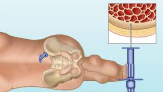 Old Dog Vestibular Disease  With Videos [upl. by Boehike272]