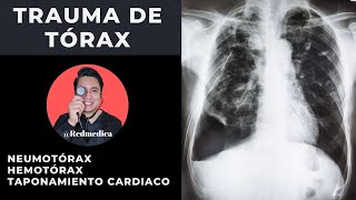 ATLS  Trauma de tórax  ENARM2021  🩺Dr Treviño [upl. by Rehpatsirhc]