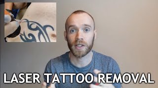 Laser Tattoo Removal  Sessions 13 Update [upl. by Herald]