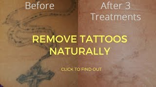 How To Remove Tattoos Naturally [upl. by Corin]